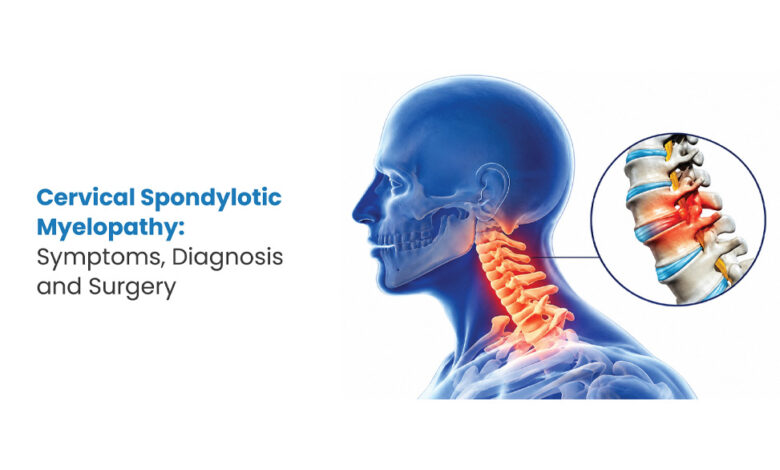 Understanding Cervical Spondylotic Myelopathy: Symptoms, Diagnosis and Treatment