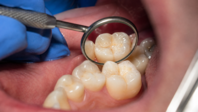 United States Veterans Dental Care Access: Planning and Paying for Treatment